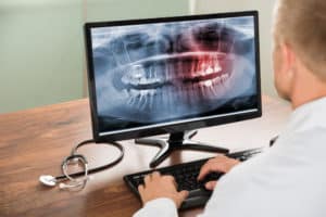 3 Important Advantages of Digital X-Rays