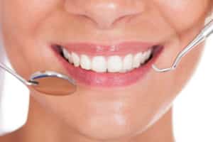 why are dental cleanings so important