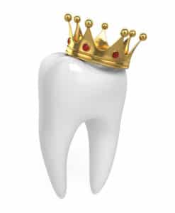 could your tooth use a dental crown