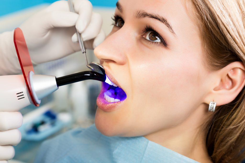 Syosset Dentist Explains How We Offer Fillings No One Can See Syosset, NY