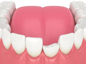 syosset full mouth rehabilitation