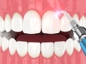 syosset dental technology