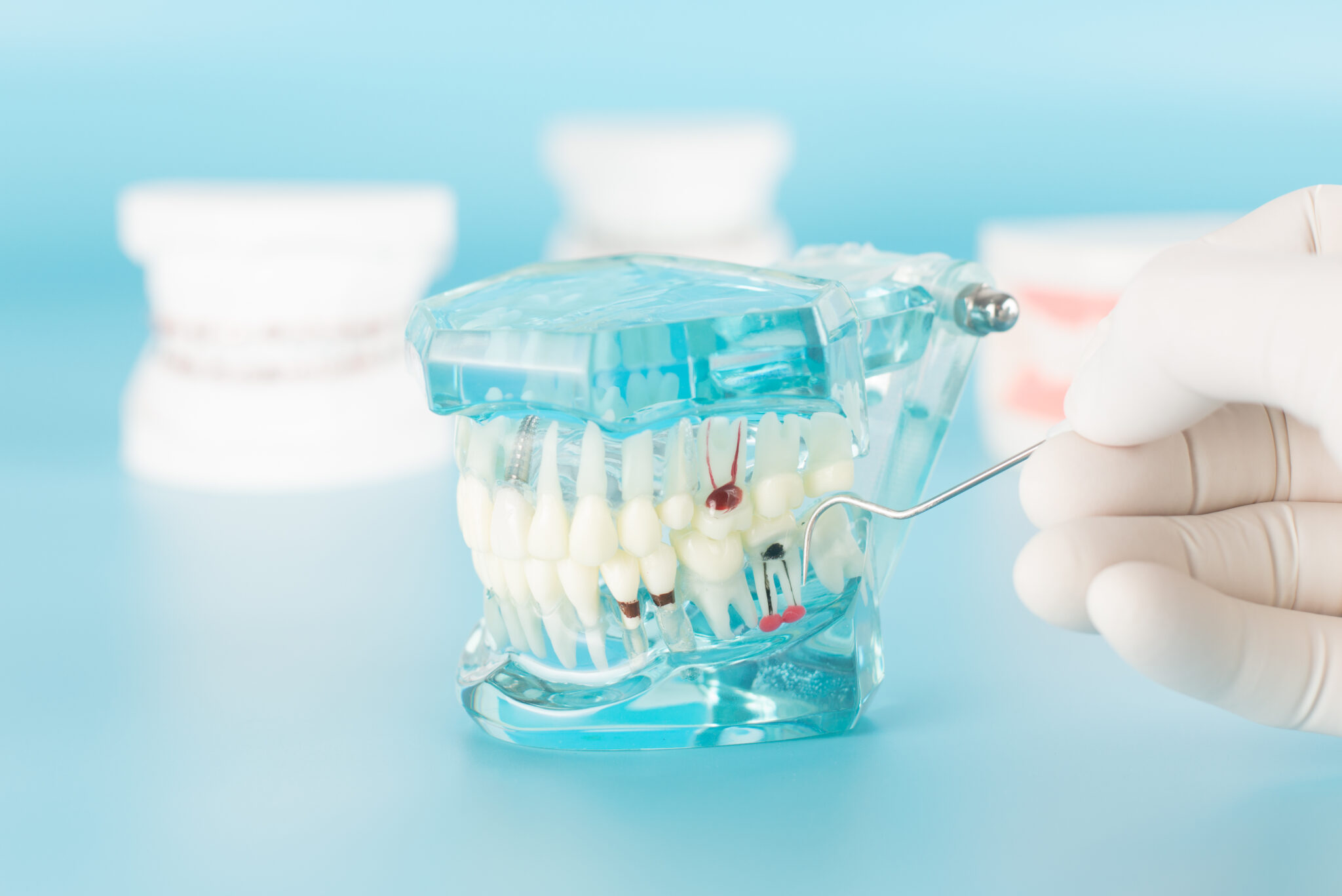 Could A Root Canal Be Comfortable? Syosset, NY
