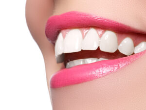 Syosset teeth whitening