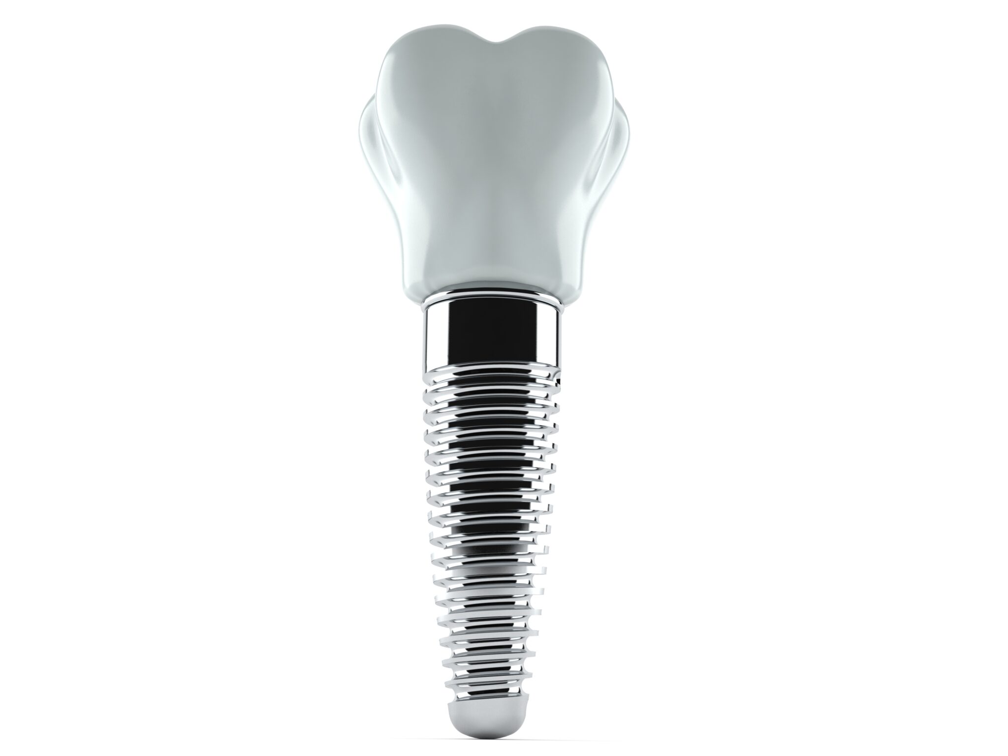 The Stability And Esthetics Of Implants Syosset, NY
