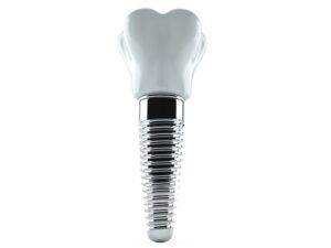 syosset dental implants