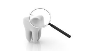 syosset root canal