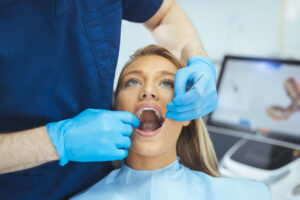 syosset dental fillings