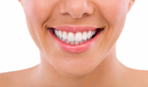 syosset veneers