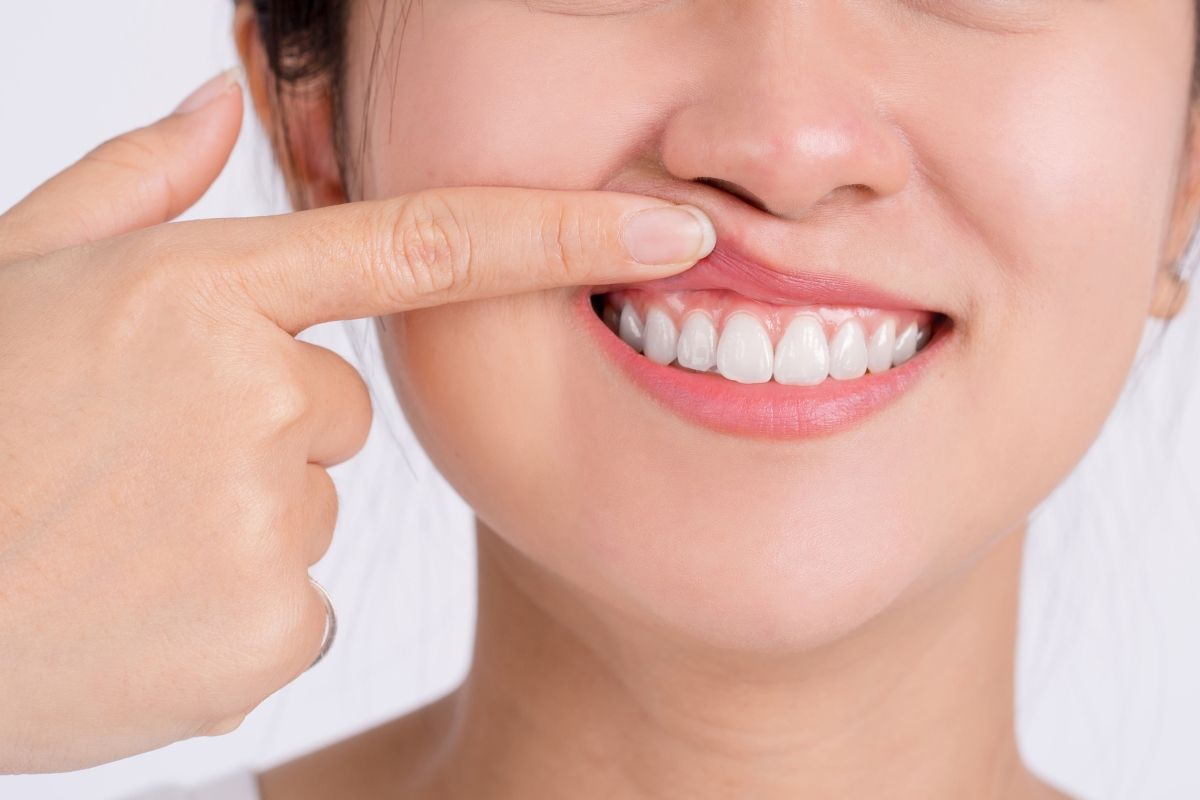 How Diet Impacts Periodontal Health