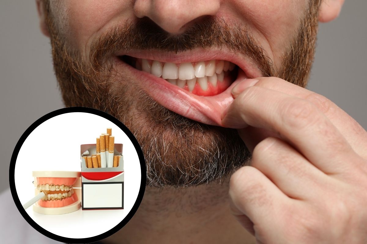 periodontal treatment in syosset