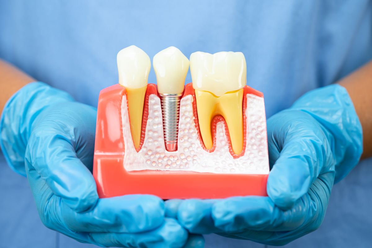 Close view of dental implant placement and gum health model