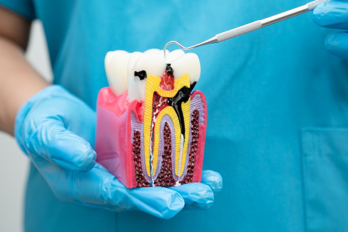 Root Canal Treatment for Different Teeth Types